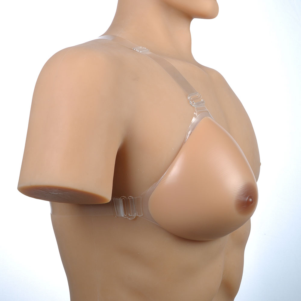 Prothèse mammaire post-mastectomie asymétrique